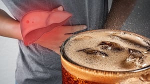 El refresco es una de las bebidas más populares en todo el mundo y suele acompañar comidas y actividades cotidianas. Sin embargo, especialistas de la Cleveland