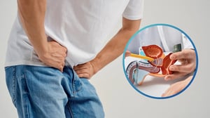 La hiperplasia prostática benigna (HPB), también conocida como agrandamiento de la próstata, es una afección no cancerosa en la que el tejido prostático
