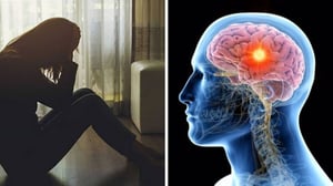 Un nuevo estudio sugiere que la conexión entre la depresión y el deterioro cerebral asociado al envejecimiento podría variar según