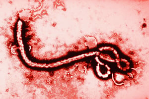El ébola ha vuelto a generar preocupación a nivel internacional tras detectarse un nuevo brote en África central. Aunque su alta tasa de mortalidad alarma,