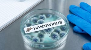 La alerta por el hantavirus volvió a incrementarse en Norteamérica después de que autoridades de salud en Colorado confirmaran el primer fallecimiento por esta