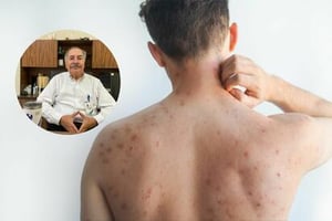 Autoridades sanitarias mantienen vigilancia epidemiológica y refuerzan campañas permanentes de vacunación preventiva regional.  Aunque durante este