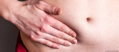 Aumentan los casos de cáncer de apéndice entre jóvenes adultos