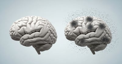 Siete avances esperanzadores que redefinen el tratamiento de la demencia