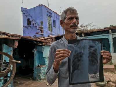 Qué es la silicosis, la enfermedad que daña los pulmones de los trabajadores de la construcción
