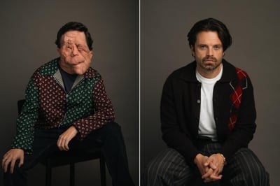 2026 Oscar: ¿Qué es la neurofibromatosis? La enfermedad que padece el actor Adam Pearson