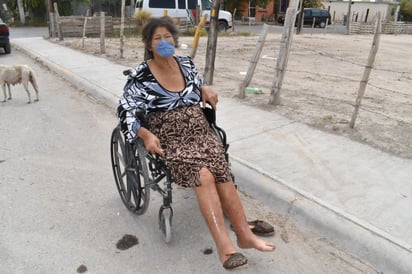 Afecta sus ojos  polvo  de la calle donde vive