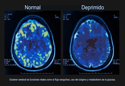 Depresión, la enfermedad del siglo XXI