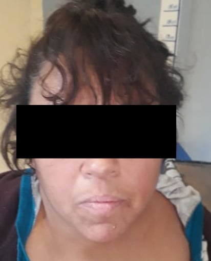 Aseguran a agresiva mujer en Monclova