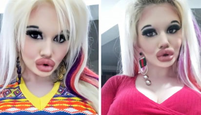 La influencer con los labios más gruesos del mundo