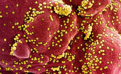 Anticuerpos por coronavirus primordial combaten las nuevas variantes