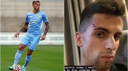 Hieren Joao Cancelo jugador del Manchester City en un violento robo en su casa