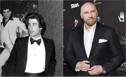 Víctimas de tratamientos estéticos: El antes y después de John Travolta, Melanie Griffith y otros famosos