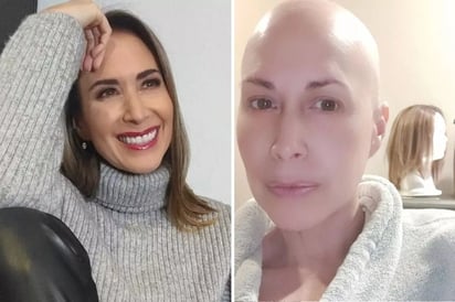 Marta Guzmán comparte su primera foto sin cabello tras luchar contra el cáncer de mama