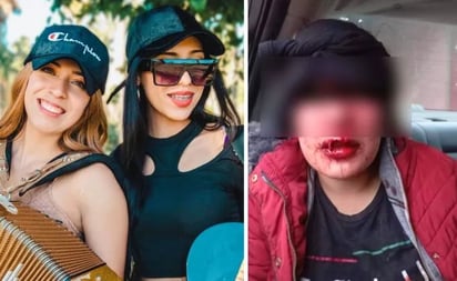 Asaltan y golpean a integrantes del Grupo Emperatriz en Tijuana