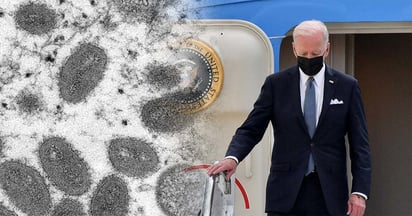 Biden alerta: Viruela del mono debe preocupar al mundo: Viruela del Mono, Biden, Alerta