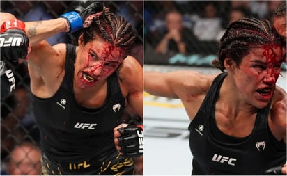 Peleadora de la UFC pierde trozo de frente en combate