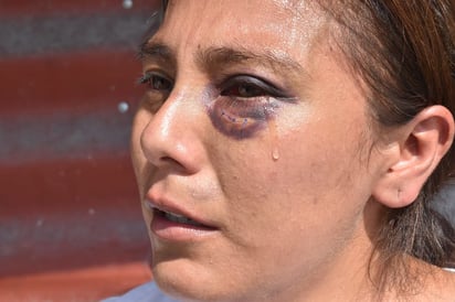 Mujer denuncia a su hermano por golpiza