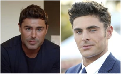 Zac Efron explica por qué su cara lucía tan diferente ¿Se acuerdan?