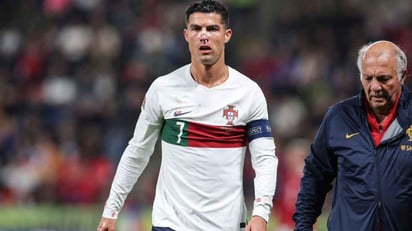 Con un accidentado CR7, Portugal aplastó a República Checa