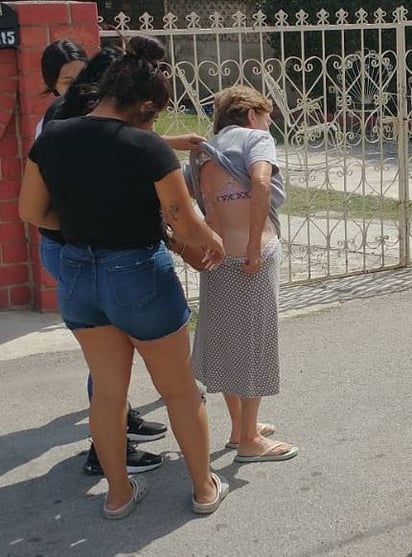 Mujer es atacada por jauría de perros en la colonia Buena Vista en Piedras Negras 