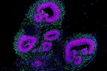 Implantan células del cerebro humano en ratas, esto podría ayudar a explicar los trastornos