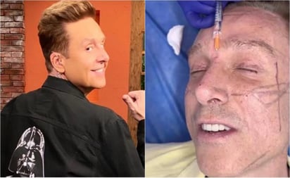 Daniel Bisogno se sometió a rejuvenecimiento facial, este fue el resultado