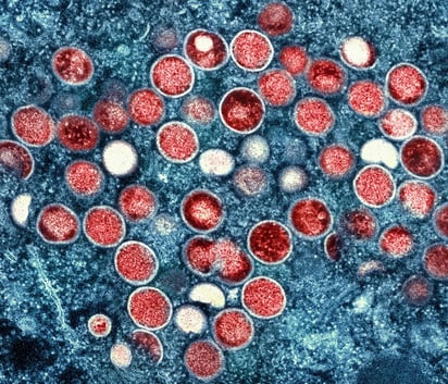 OMS cambia el nombre de la viruela del mono a 'mpox'