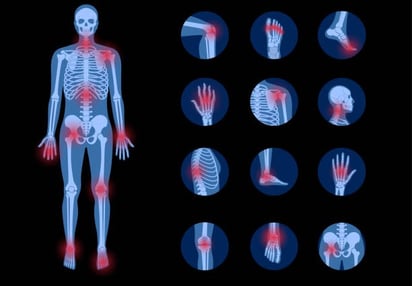 Ejercicios para mejorar los síntomas de la artrosis