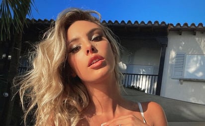 Lele Pons: esta es la cirugía que le cambió la vida a la sobrina de Chayanne