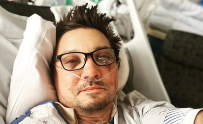 Jeremy Renner se rompe más de 30 huesos en su accidente y muestra su recuperación