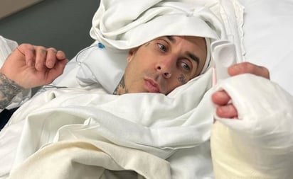 Blink-182: Travis Barker sube impactante fotografía de la operación en su dedo tras cancelación de gira: La banda se presentaría en Monterrey en el Pal Norte 2023