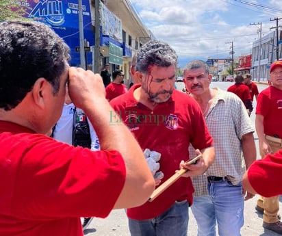 Obrero pierde ojo y cuatro más resultan lesionados en enfrentamiento