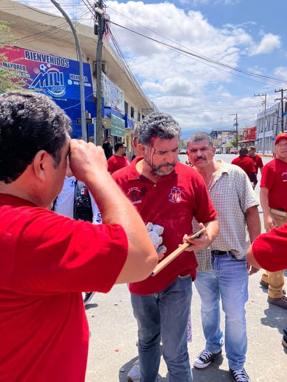 Obrero pierde ojo y cuatro más resultan lesionados en enfrentamiento