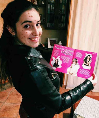 La influencer 'body positive' con padecimiento en la piel que ganó un concurso de belleza: La chica que superó sus inseguridades y se volvió modelo.