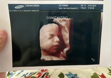 Mujeres denuncian a clínica que usa la misma ecografía para diferentes pacientes: Clínica estafa mujeres con la misma fotografía después de realizar supuesta ecografía especializada