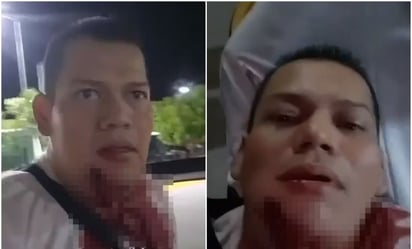 'Me pegaron, ¡ayúdenme!': balean a activista que criticaba inseguridad en Apatzingán; transmite en vivo aún herido