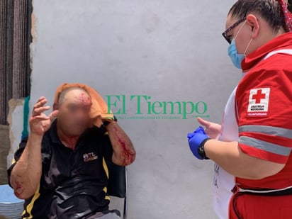 Hombre fue golpeado por exnovio de hijastra en la 21 de Marzo