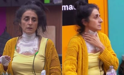 ¿Qué le pasó a Bárbara Torres, tras accidente en la cocina de 'LCDLF'?