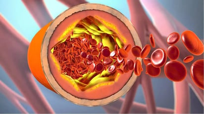 ¿Cuáles son los tipos de colesterol y cómo afectan la salud?