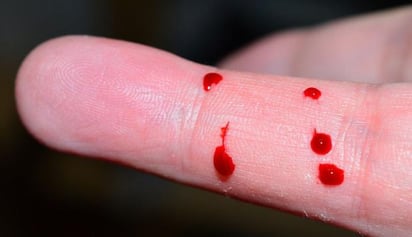 ¿Qué es la hematofobia, el temor que sienten las personas al ver sangre?