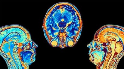 Covid: el estudio que muestra cómo cambia el cerebro tras una infección por coronavirus, aunque esta sea leve