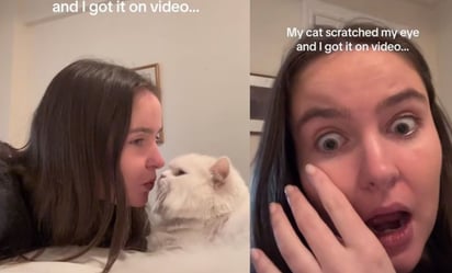 TikTok: Gato le araña el ojo a su dueña y por poco la hace perder la vista