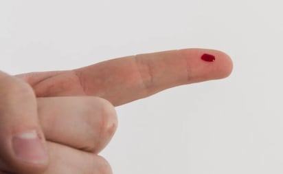 Crean una prueba para detectar un infarto con una gota de sangre