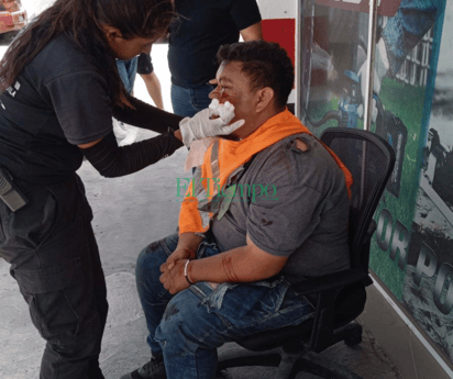 Motociclista termina sin dientes al chocar contra auto