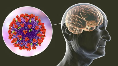 El deterioro cognitivo es una característica posCOVID-19