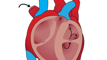 Prevención del riesgo cardiovascular en niños con peso corporal elevado