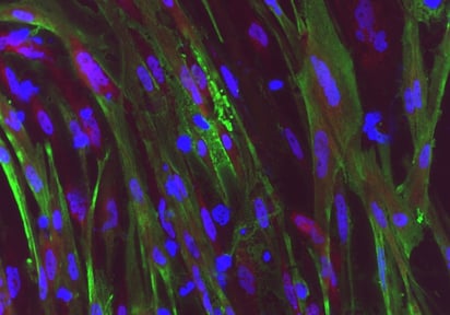 La edición genética corrige una distrofia muscular en el laboratorio y abre la puerta a su reparación