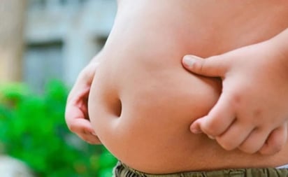 Cuál es la consecuencia de la obesidad infantil