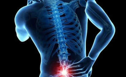 ¿Qué causa dolor lumbar?